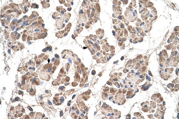 MOSPD3 antibody LS-C40504 IHC of formalin-fixed, paraffin-embedded human Muscle. Positive label: Skeletal muscle cells indicated with arrows. Antibody concentration 4-8 ug/ml. Magnification 400X.
