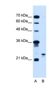 MOSPD3 antibody LS-C40504 Western blot of Jurkat lysate.