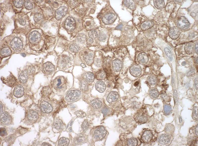 Detection of Human MOV10 by Immunohistochemistry. Sample: FFPE section of human testicular seminoma. Antibody: monoclonal MOV10 antibody used at a dilution of 1:1000.