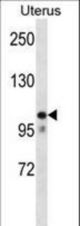 MOV10 Antibody western blot of human normal Uterus tissue lysates (35 ug/lane). The MOV10 antibody detected the MOV10 protein (arrow).