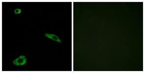 Immunofluorescence of MCF7 cells, using ACTHR Antibody. The picture on the right is treated with the synthesized peptide.