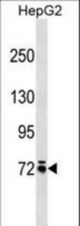 MOXD1 Antibody western blot of HepG2 cell line lysates (35 ug/lane). The MOXD1 antibody detected the MOXD1 protein (arrow).