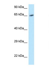 MOXD1 antibody LS-C145787 Western blot of HeLa Cell lysate. Antibody concentration 1 ug/ml.