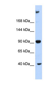 MPDZ antibody LS-B5738 Western blot of Fetal Liver lysate.