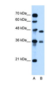MPG antibody LS-C40493 Western blot of Jurkat lysate.