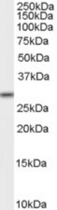 Antibody staining (2 ug/ml) of K562 lysate (RIPA buffer, 35 ug total protein per lane). Primary incubated for 1 hour. Detected by Western blot of chemiluminescence.
