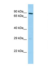 MPHOSPH10 antibody LS-C146404 Western blot of Mouse Thymus lysate. Antibody concentration 1 ug/ml.