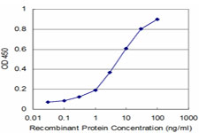 Detection limit for recombinant GST tagged MPHOSPH10 is approximately 0.3 ng/ml as a capture antibody.