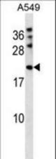 MPHOSPH6 Antibody western blot of A549 cell line lysates (35 ug/lane). The MPHOSPH6 antibody detected the MPHOSPH6 protein (arrow).