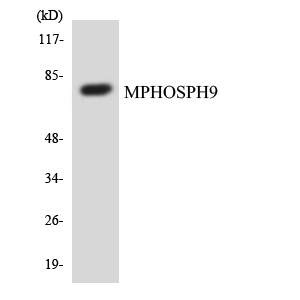 Western blot of the lysates from COLO205 cells using MPHOSPH9 antibody.