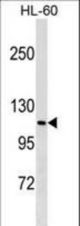 MPHOSPH9 Antibody western blot of HL-60 cell line lysates (35 ug/lane). The MPHOSPH9 antibody detected the MPHOSPH9 protein (arrow).