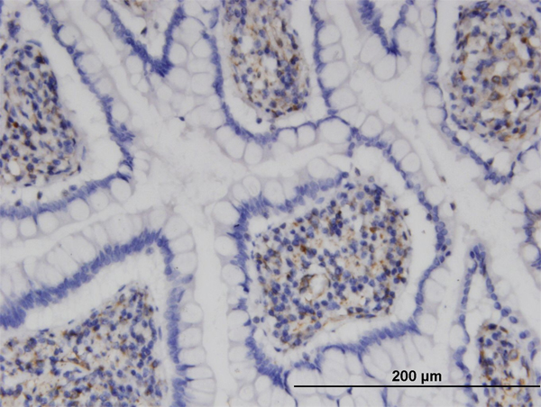Immunoperoxidase of monoclonal antibody to MPHOSPH9 on formalin-fixed paraffin-embedded human small Intestine. [antibody concentration 3 ug/ml]
