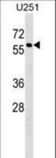 MPI Antibody western blot of U251 cell line lysates (35 ug/lane). The MPI antibody detected the MPI protein (arrow).