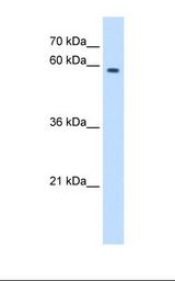 HepG2 cell lysate. Antibody concentration: 2.5 ug/ml. Gel concentration: 12%.