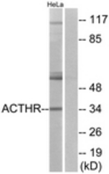 Western blot of extracts from HeLa cells, using ACTHR Antibody. The lane on the right is treated with the synthesized peptide.