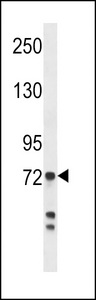 Myeloperoxidase Antibody western blot of MDA-MB231 cell line lysates (35 ug/lane). The Myeloperoxidase antibody detected the Myeloperoxidase protein (arrow).