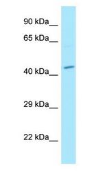 MPP1 antibody Western Blot of NCI-H226.