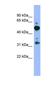 MPP2 antibody LS-C107758 Western blot of 293T cell lysate.