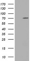 HEK293T cells were transfected with the pCMV6-ENTRY control (Left lane) or pCMV6-ENTRY MPP3 (Right lane) cDNA for 48 hrs and lysed. Equivalent amounts of cell lysates (5 ug per lane) were separated by SDS-PAGE and immunoblotted with anti-MPP3.