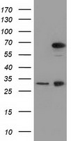 HEK293T cells were transfected with the pCMV6-ENTRY control (Left lane) or pCMV6-ENTRY MPP3 (Right lane) cDNA for 48 hrs and lysed. Equivalent amounts of cell lysates (5 ug per lane) were separated by SDS-PAGE and immunoblotted with anti-MPP3.