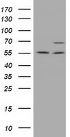 HEK293T cells were transfected with the pCMV6-ENTRY control (Left lane) or pCMV6-ENTRY MPP3 (Right lane) cDNA for 48 hrs and lysed. Equivalent amounts of cell lysates (5 ug per lane) were separated by SDS-PAGE and immunoblotted with anti-MPP3.
