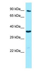MPP4 / Discs Large Homolog 6 antibody Western Blot of Jurkat.
