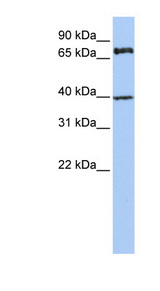 MPP5 antibody LS-C101989 Western blot of Jurkat lysate.