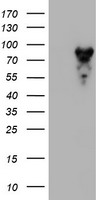 HEK293T cells were transfected with the pCMV6-ENTRY control (Left lane) or pCMV6-ENTRY MPP5 (Right lane) cDNA for 48 hrs and lysed. Equivalent amounts of cell lysates (5 ug per lane) were separated by SDS-PAGE and immunoblotted with anti-MPP5.
