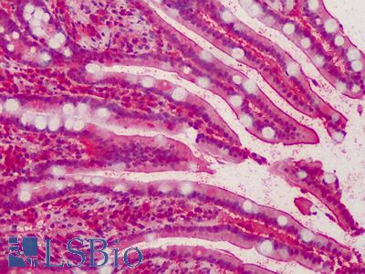 Anti-MPP5 antibody IHC of human small intestine. Immunohistochemistry of formalin-fixed, paraffin-embedded tissue after heat-induced antigen retrieval. Antibody LS-B2285 concentration 5 ug/ml.