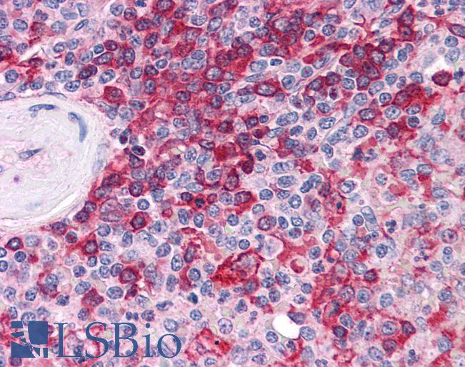 Anti-MPP5 antibody IHC of human spleen. Immunohistochemistry of formalin-fixed, paraffin-embedded tissue after heat-induced antigen retrieval. Antibody LS-B4831 concentration 10 ug/ml.