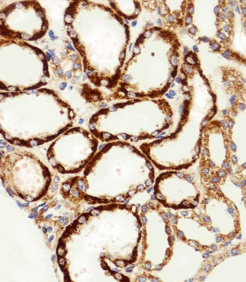Immunohistochemical of paraffin-embedded H. kidney section using MPP7 Antibody. Antibody was diluted at 1:100 dilution. A peroxidase-conjugated goat anti-rabbit IgG at 1:400 dilution was used as the secondary antibody, followed by DAB staining.