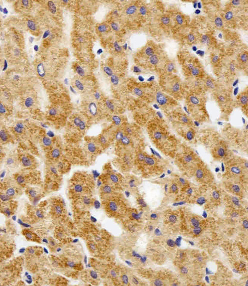 Immunohistochemical of paraffin-embedded H. liver section using MPP7 Antibody. Antibody was diluted at 1:100 dilution. A peroxidase-conjugated goat anti-rabbit IgG at 1:400 dilution was used as the secondary antibody, followed by DAB staining.