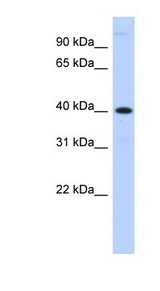 MPPE1 antibody LS-C102344 Western blot of Transfected 293T cell lysate.