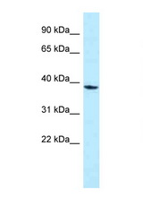 MPPED1 antibody LS-C145890 Western blot of Jurkat Cell lysate. Antibody concentration 1 ug/ml.