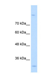 MPPED2 antibody LS-C40356 Western blot of A204 cell lysate.