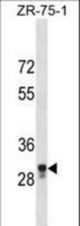MPPED2 Antibody western blot of ZR-75-1 cell line lysates (35 ug/lane). The MPPED2 antibody detected the MPPED2 protein (arrow).