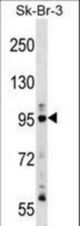 TTK Antibody western blot of SK-BR-3 cell line lysates (35 ug/lane). The TTK antibody detected the TTK protein (arrow).