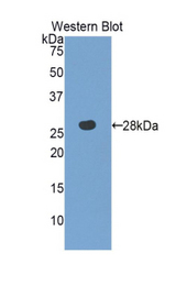 Western blot of recombinant MPST.