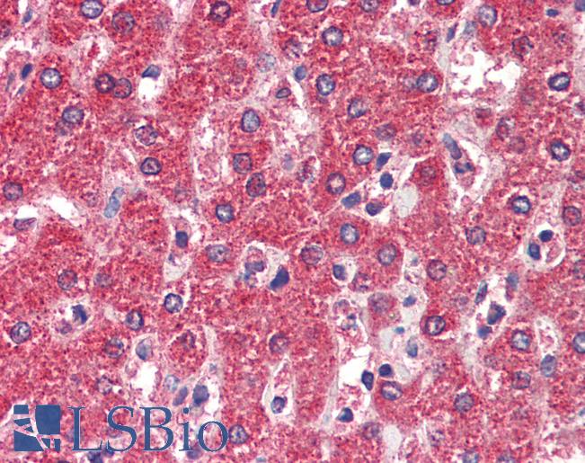 Anti-MPV17 antibody IHC staining of human liver. Immunohistochemistry of formalin-fixed, paraffin-embedded tissue after heat-induced antigen retrieval. Antibody LS-B9529 concentration 5 ug/ml.