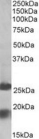 MPV17 antibody (2 ug/ml) staining of Human Frontal Cortex lysate (35 ug protein/ml in RIPA buffer). Primary incubation was 1 hour. Detected by chemiluminescence.