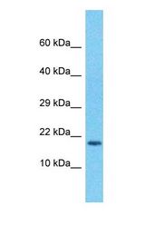 Western blot of MPV17 Antibody with human ACHN Whole Cell lysate.