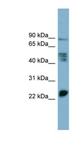 MPZL1 antibody LS-C110879 Western blot of PANC1 cell lysate.