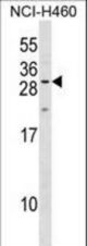 MPZL2 Antibody western blot of NCI-H460 cell line lysates (35 ug/lane). The MPZL2 antibody detected the MPZL2 protein (arrow).