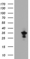 HEK293T cells were transfected with the pCMV6-ENTRY control (Left lane) or pCMV6-ENTRY MPZL2 (Right lane) cDNA for 48 hrs and lysed. Equivalent amounts of cell lysates (5 ug per lane) were separated by SDS-PAGE and immunoblotted with anti-MPZL2.