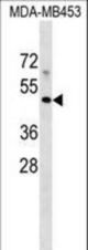 MR1 Antibody western blot of MDA-MB453 cell line lysates (35 ug/lane). The MR1 antibody detected the MR1 protein (arrow).