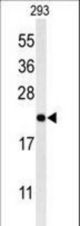 Western blot of MRAP Antibody in 293 cell line lysates (35 ug/lane). MRAP (arrow) was detected using the purified antibody.