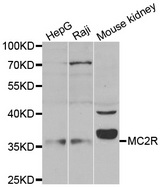 Western blot analysis of extracts of 293 cell lysate, using MC2R antibody.