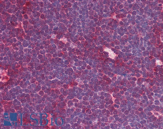Anti-MRE11A / MRE11 antibody IHC of human thymus. Immunohistochemistry of formalin-fixed, paraffin-embedded tissue after heat-induced antigen retrieval. Antibody LS-B1700 concentration 5 ug/ml.