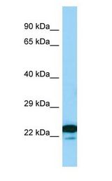 MREG antibody Western Blot of Jurkat.