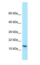 MRFAP1 / PGR1 antibody Western Blot of Jurkat cell lysate.